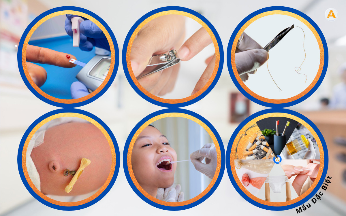 Các loại mẫu được sử dụng trong xét nghiệm ADN