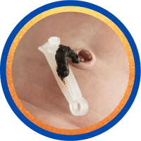 Mẫu cuống rốn làm xét nghiệm ADN