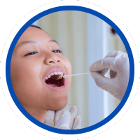 Mẫu niêm mạc miệng làm xét nghiệm ADN