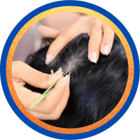 Mẫu tóc có chân làm xét nghiệm ADN